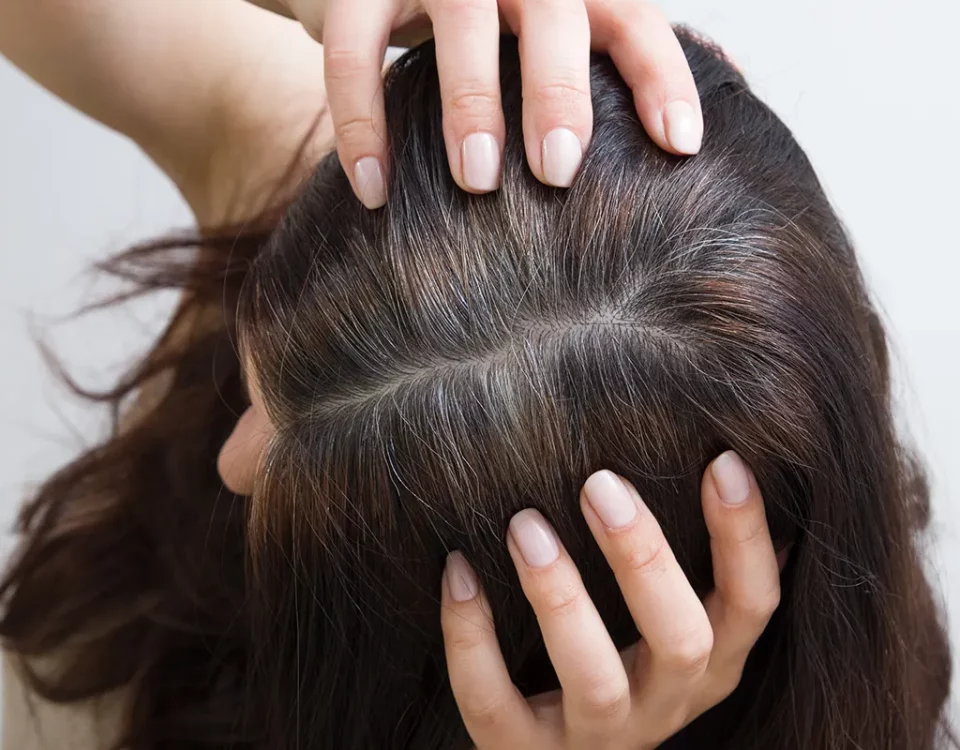 جلوگیری از سفیدی مو با معکوس کردن آن